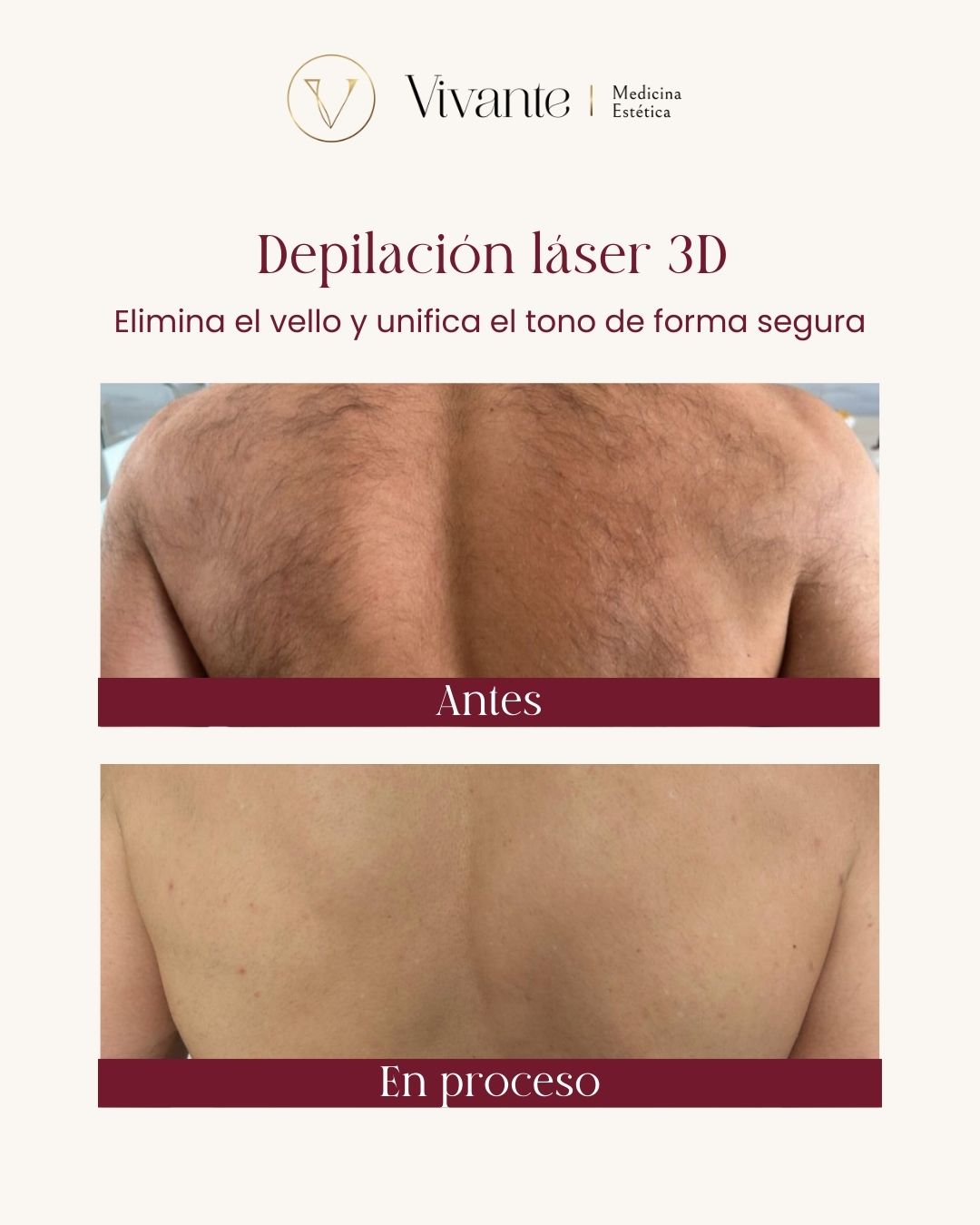 RESULTADOS DEPILACIÓN (1)