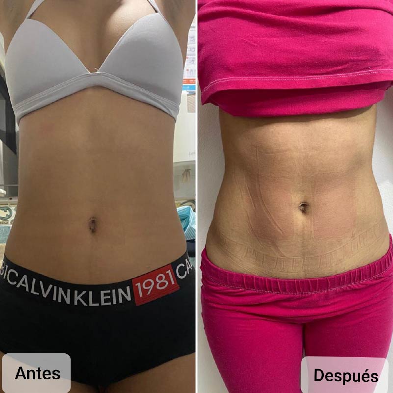 baja de peso sin entrenar barranquilla