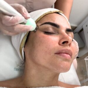 Radiofrecuencia Spectra